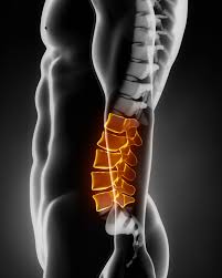 Lumbar spine with luminous orange on the lateral side