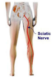 Posterior view of the sciatic nerve with the nerve marked in red on the right leg