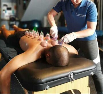 Cupping Therapy in Singapore